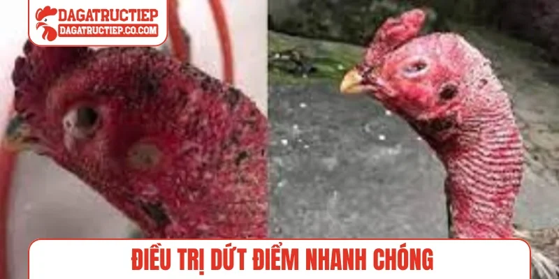 Điều trị dứt điểm nhanh chóng